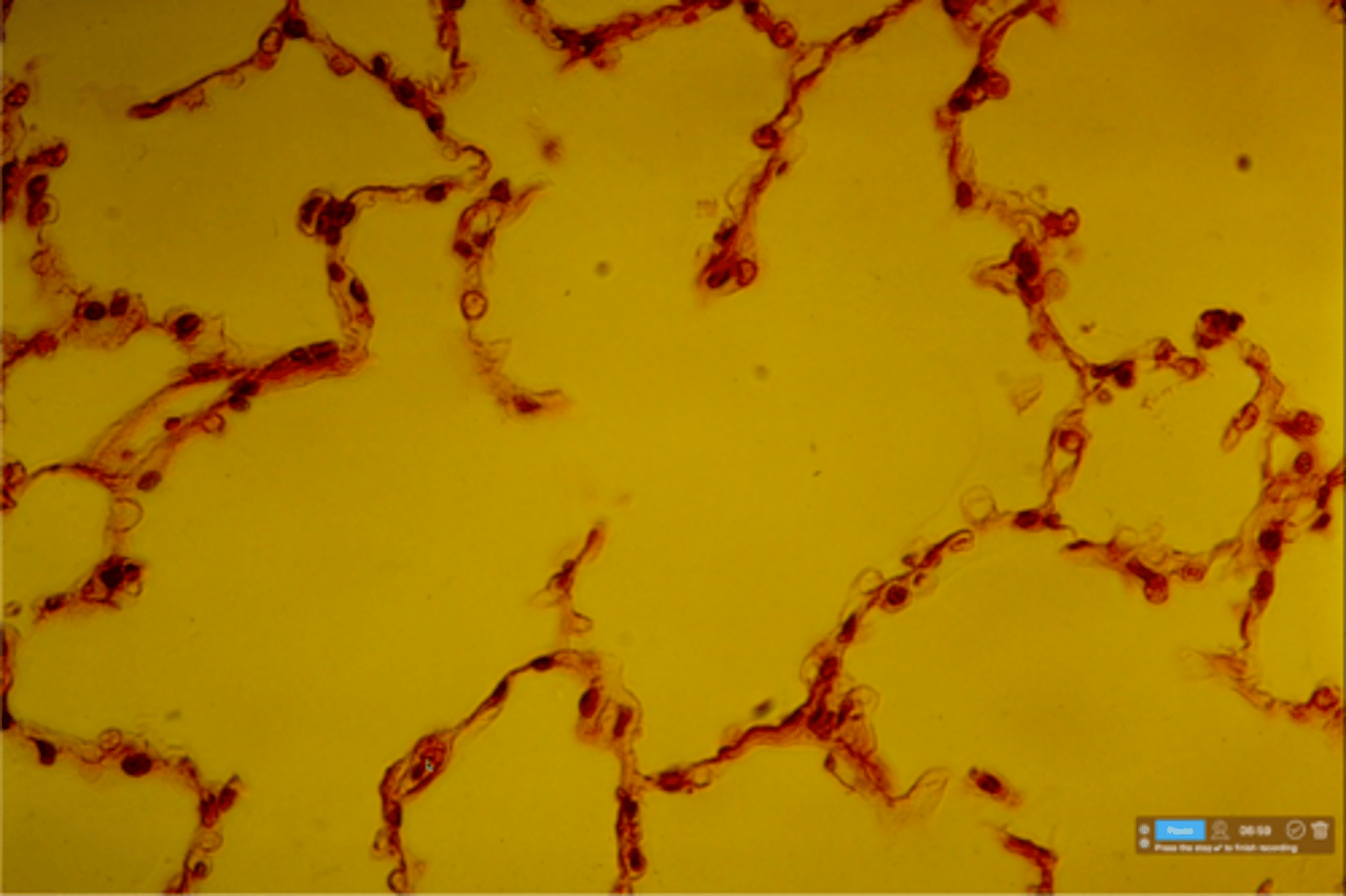 <p>Which tissue is depicted on this slide? This makes up the walls of an alveolus.</p>