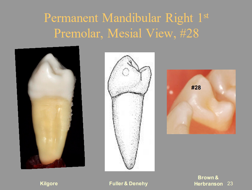 <p>Permanent Mandibular Right 1st Premolar, Mesial View, #28</p>