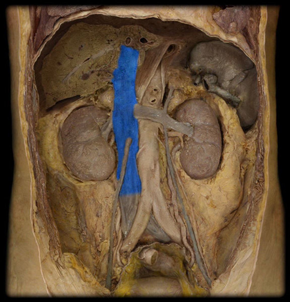 <p>Name this vessel.</p>