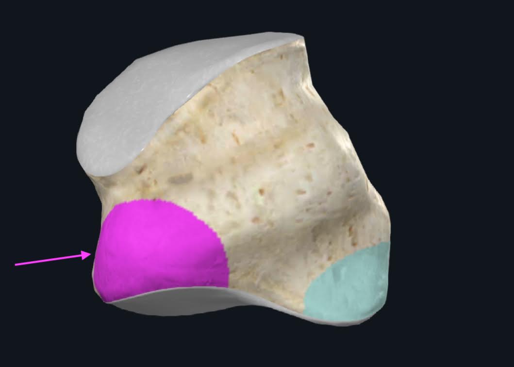 <p>Proximal al surco para el tendón del músculo peroneo largo, la cara inferior también presenta esta eminencia ósea</p>