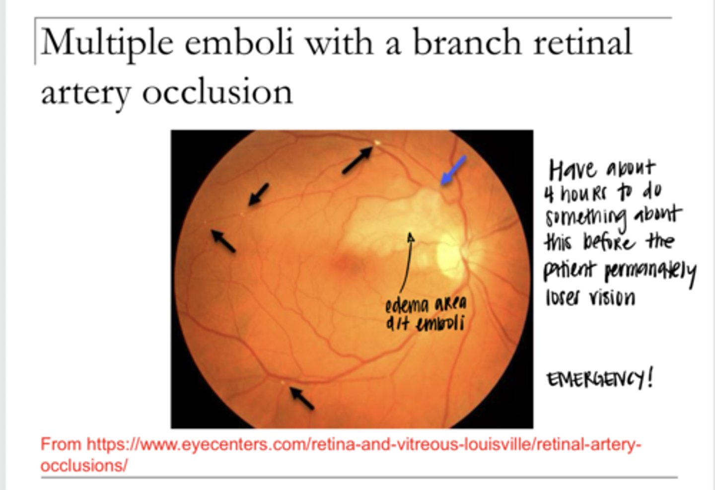 <p>Is this pic an ocular emergency?</p>