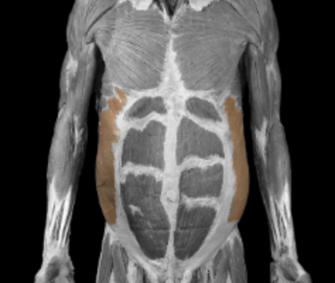 <p>What is this muscle?</p>