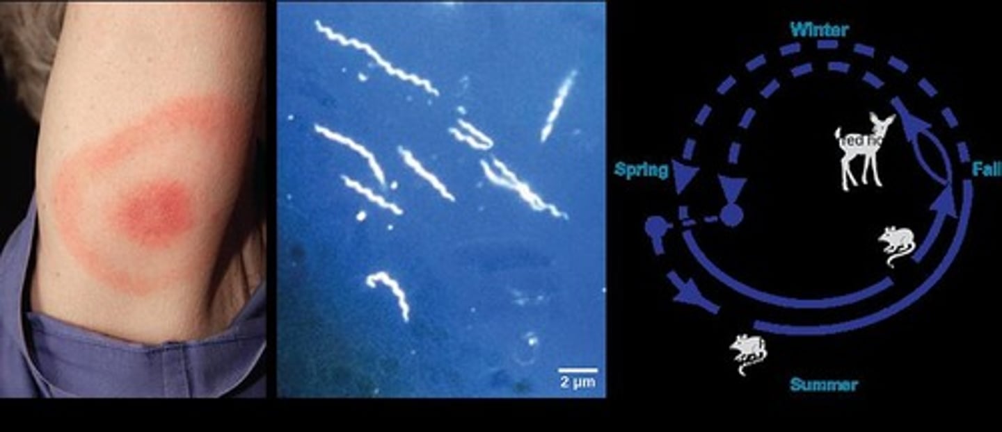 <p>A bullseye rash.</p>