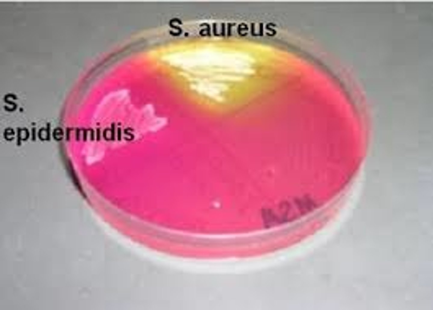 <p>What are the expected results of Staph aureus streaking on an MSA plate?</p>