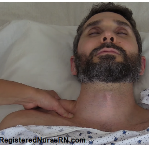 <p><span>Which type of painful stimuli is the nurse assessing?</span></p><p></p>