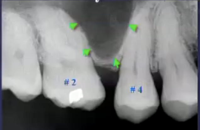 <p>what’s the pathology&nbsp;</p>