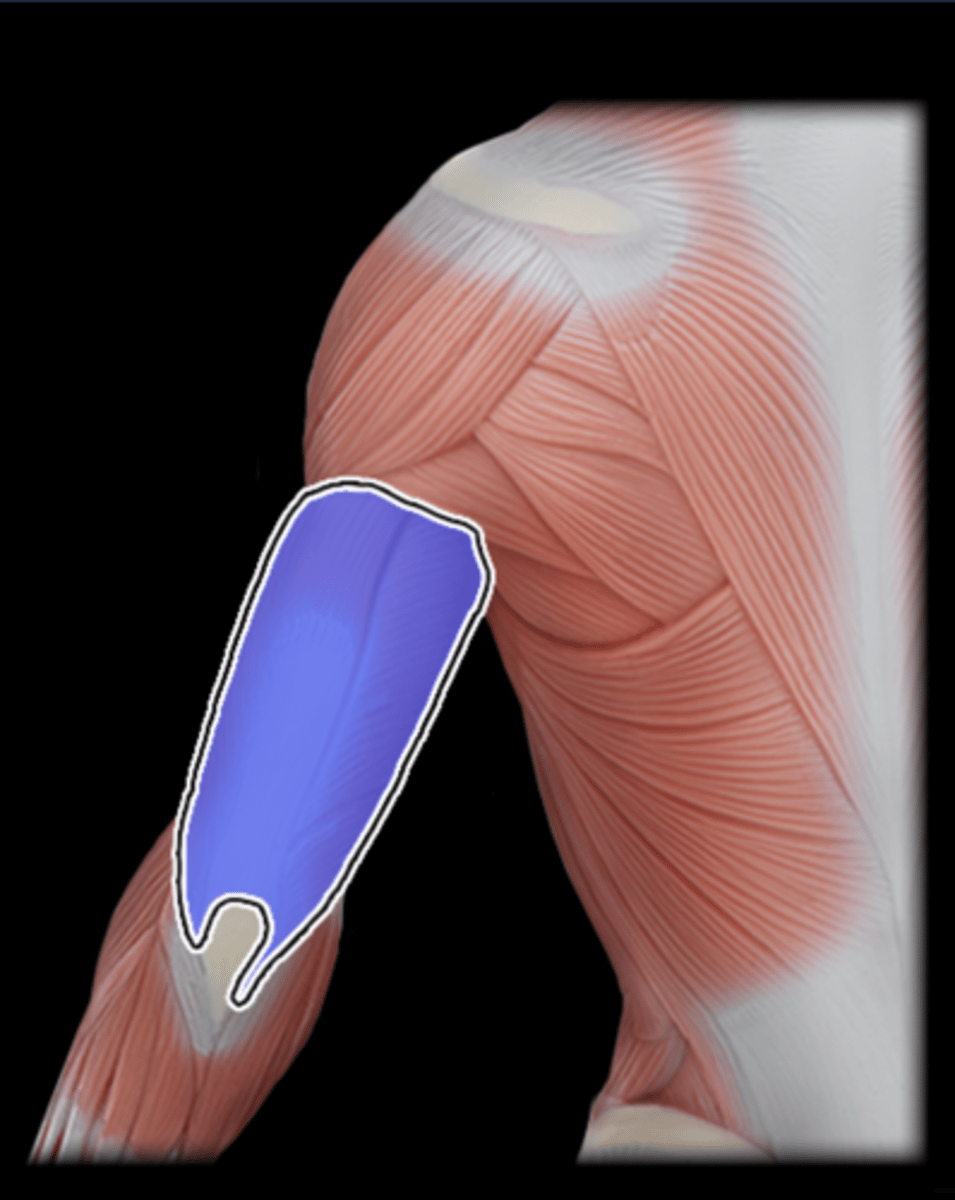 <p>What Muscle Is Highlighted?</p>