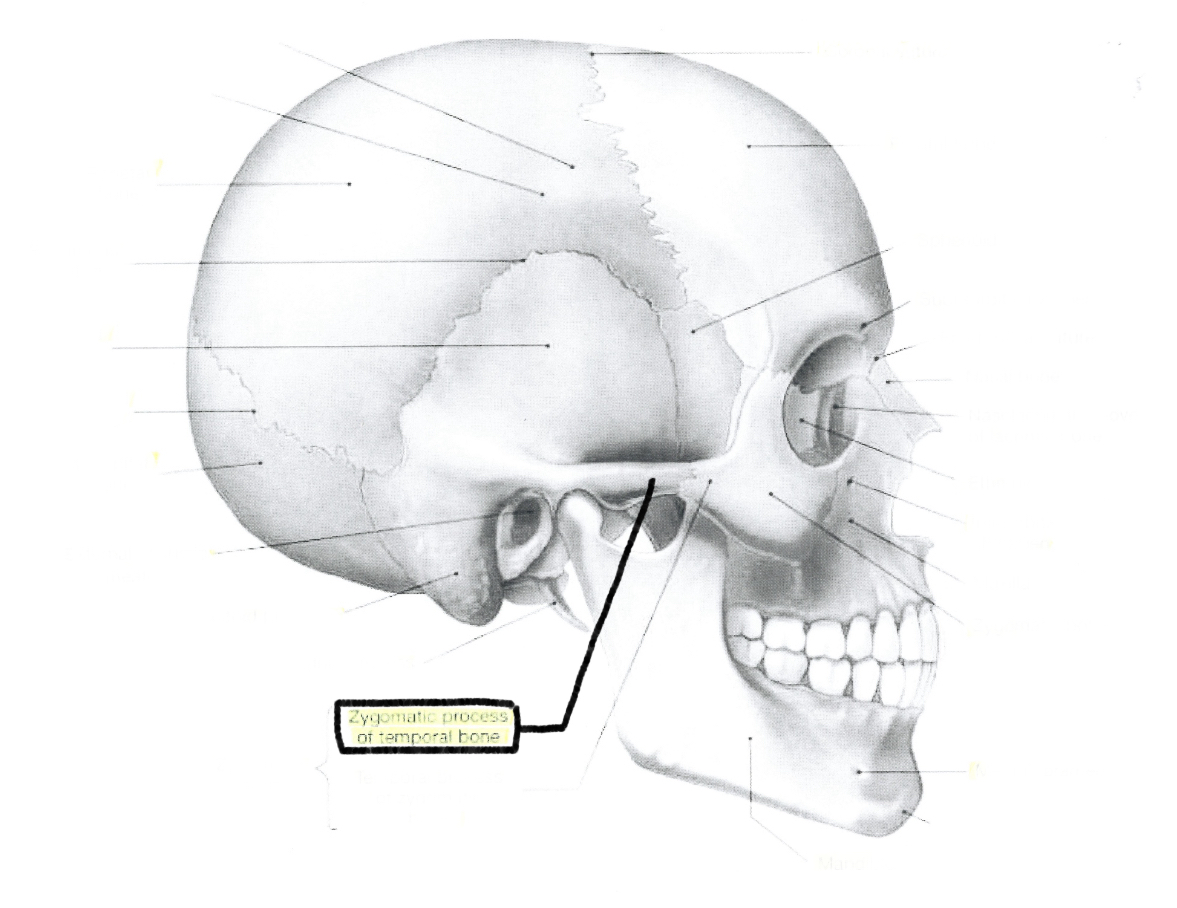 <p>Zygomatic process of temporal bone</p>