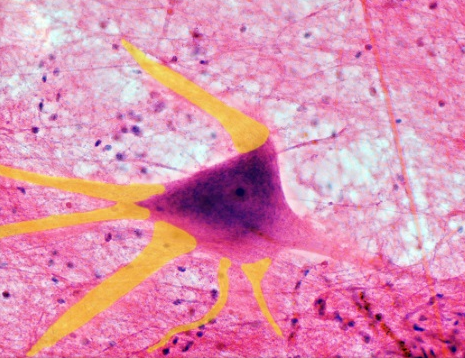 <p>what structure is highlighted?</p>