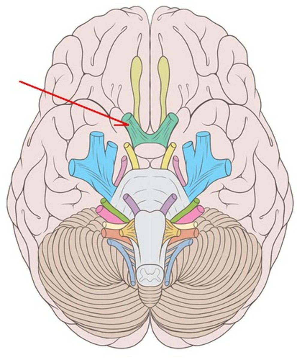 <p>Optic nerve: vision, sensory, begin in the retina of each eye. These nerves course posteriorly and are united in the optic chiasm. The fibers split again immediately posterior to the optic chiasm and extend posteriorly as the optic tracts. Associated with the thalamus. Exit at the optic canal.</p>