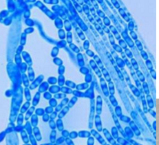 <p>Which sp is this?</p>