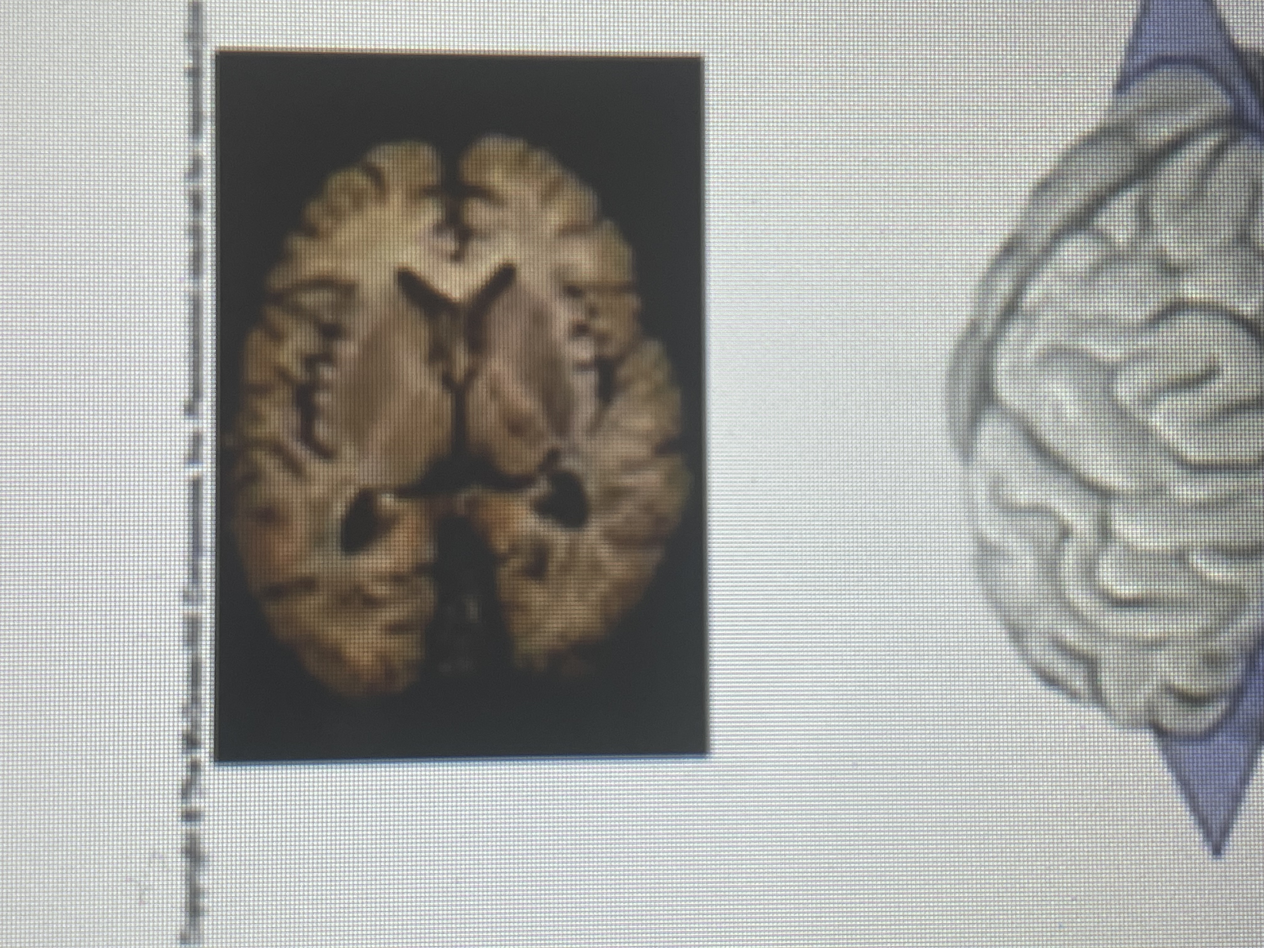 term image
