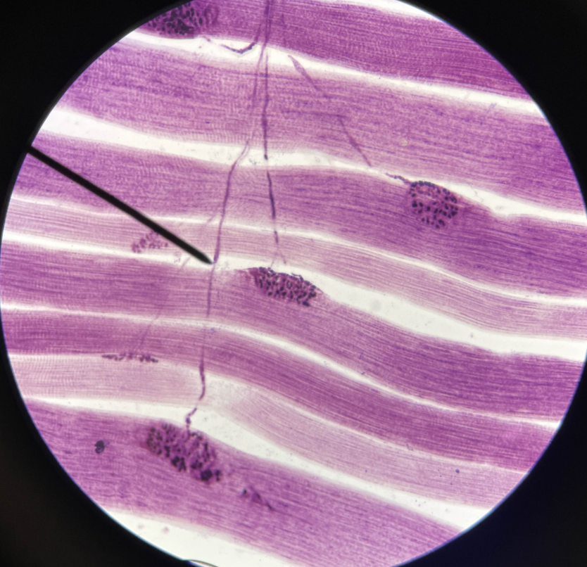 <p>What is the pointer on?</p>