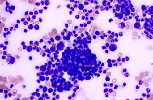<p>symptoms of <span style="color: rgb(255, 255, 255);"><span>Blastomyces dermatitidis</span></span></p>