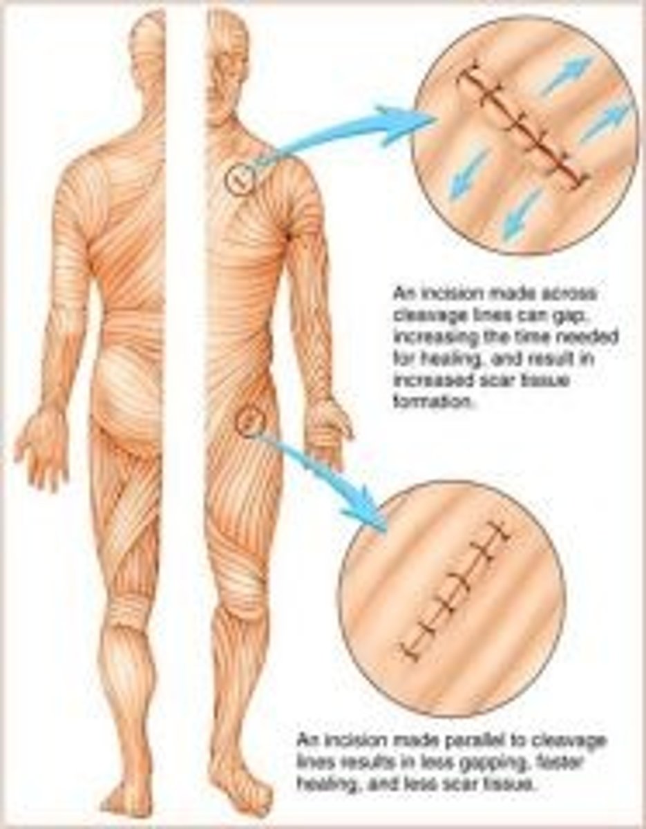 <p>in reticular layer are caused by many collagen fibers running parallel to skin surface</p><p>- Externally invisible</p><p>- Important to surgeons because incisions parallel to cleavage lines heal more readily</p>