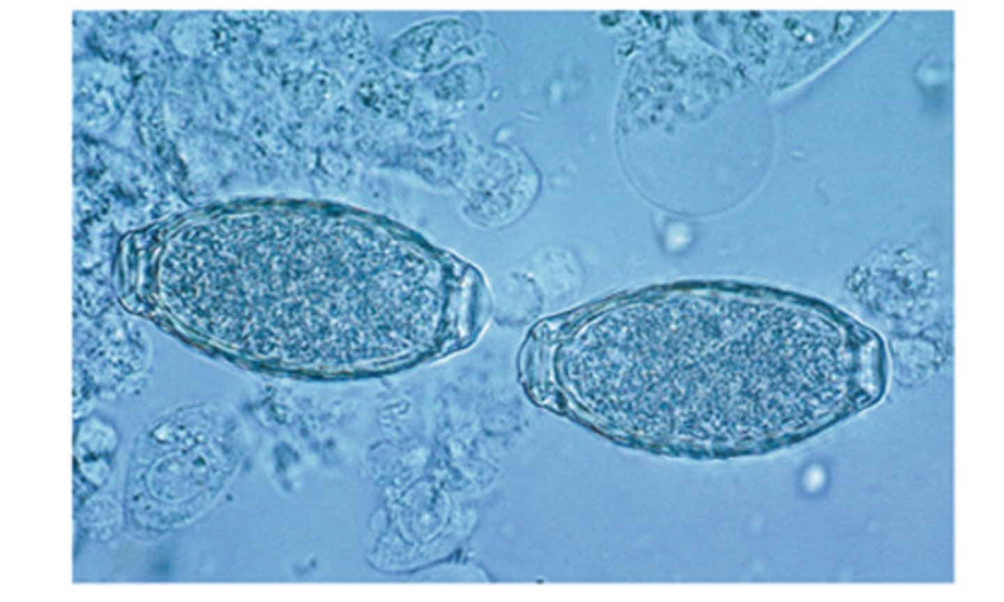 <p>This urinary nematode of dogs can be diagnosed by use of urinary sediment</p>