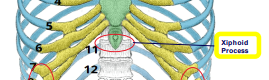 <p>bottom of sternum</p>