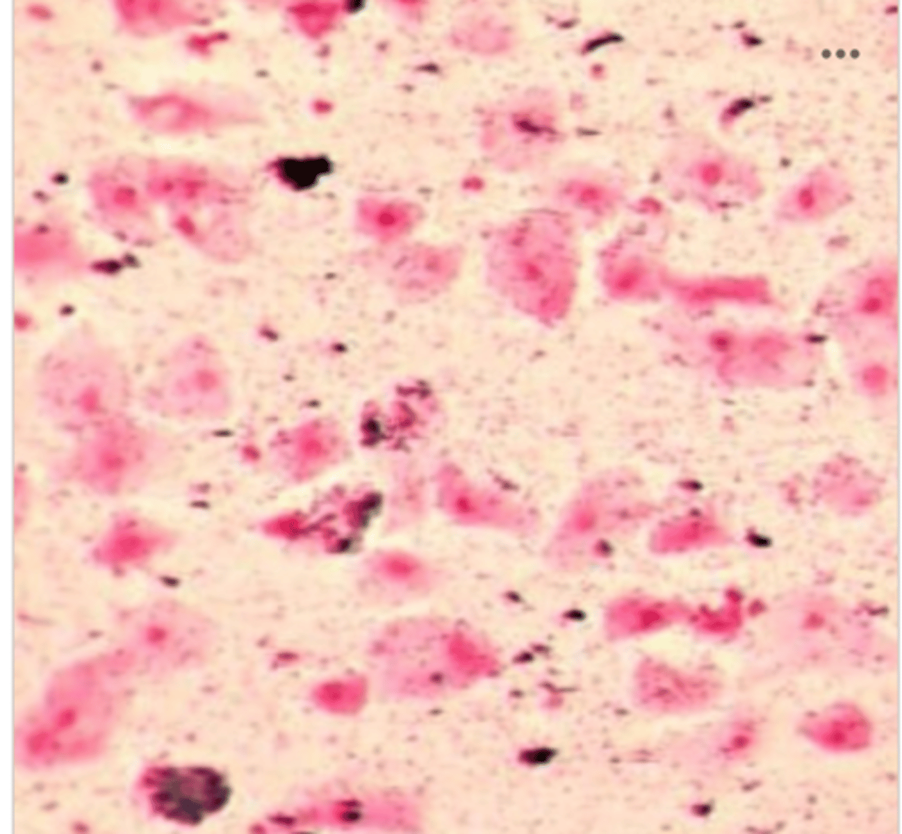 <p>A sputum was received for culture, the direct smear was performed.</p><p>Based on the representative field shown, the MLS should do what?</p>