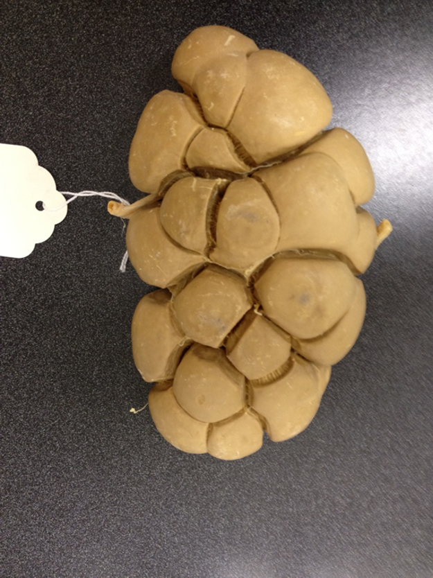 <p>Kidney</p>