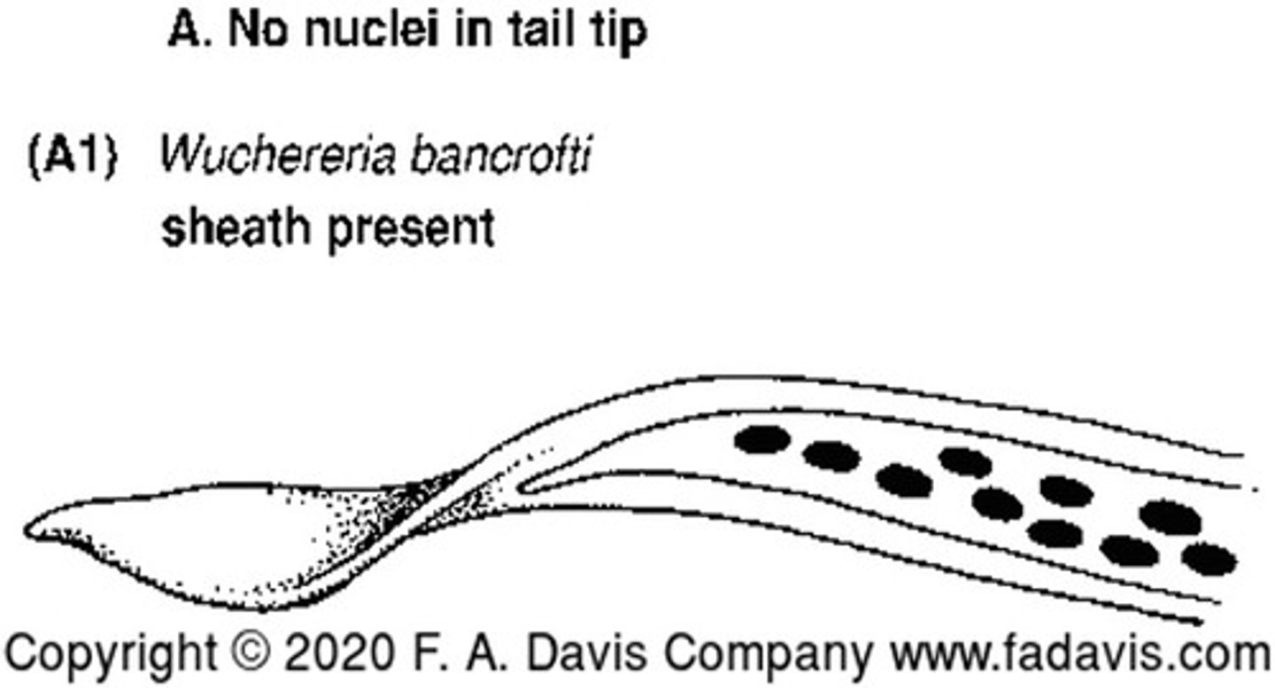 <p>No nuclei in tail tip with a sheath present<br>Causes: granulomatous lesions, fever, chills, eosinophilia, and elephantiasis</p>