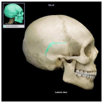 <p>Which cranial suture is this? (2)</p>