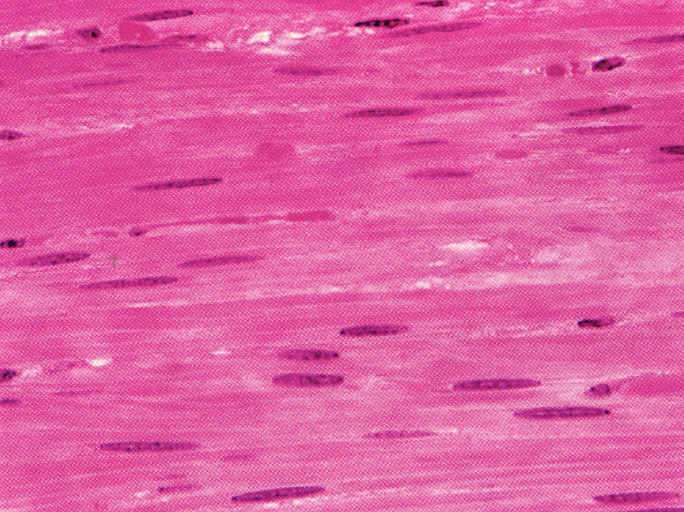 <p>What tissue is shown?</p>