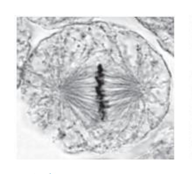 <p>what is this phase of mitosis</p>