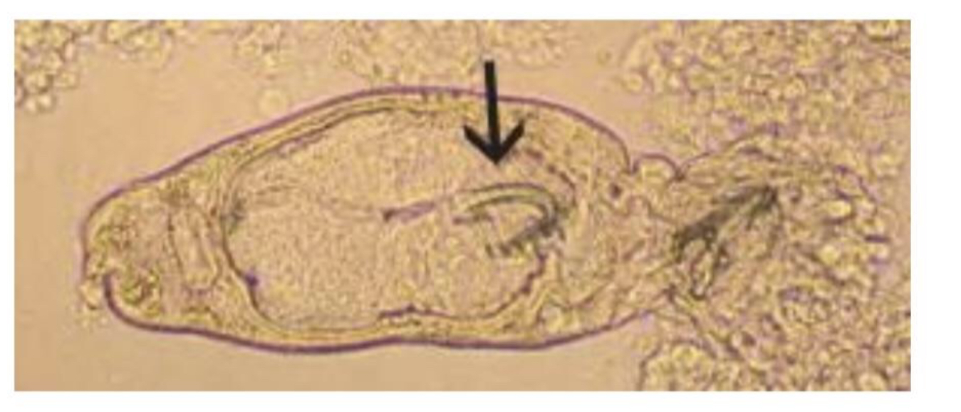 term image