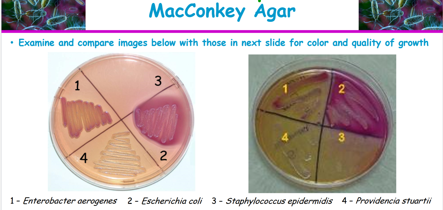 <p>staphylococcus epidermidis</p>