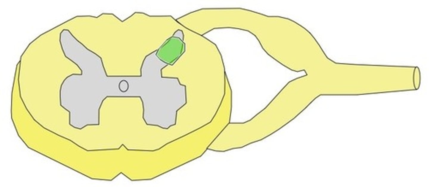 <p>Substantia gelatinosa resides in rexed laminae II and III in the dorsal horn.</p>