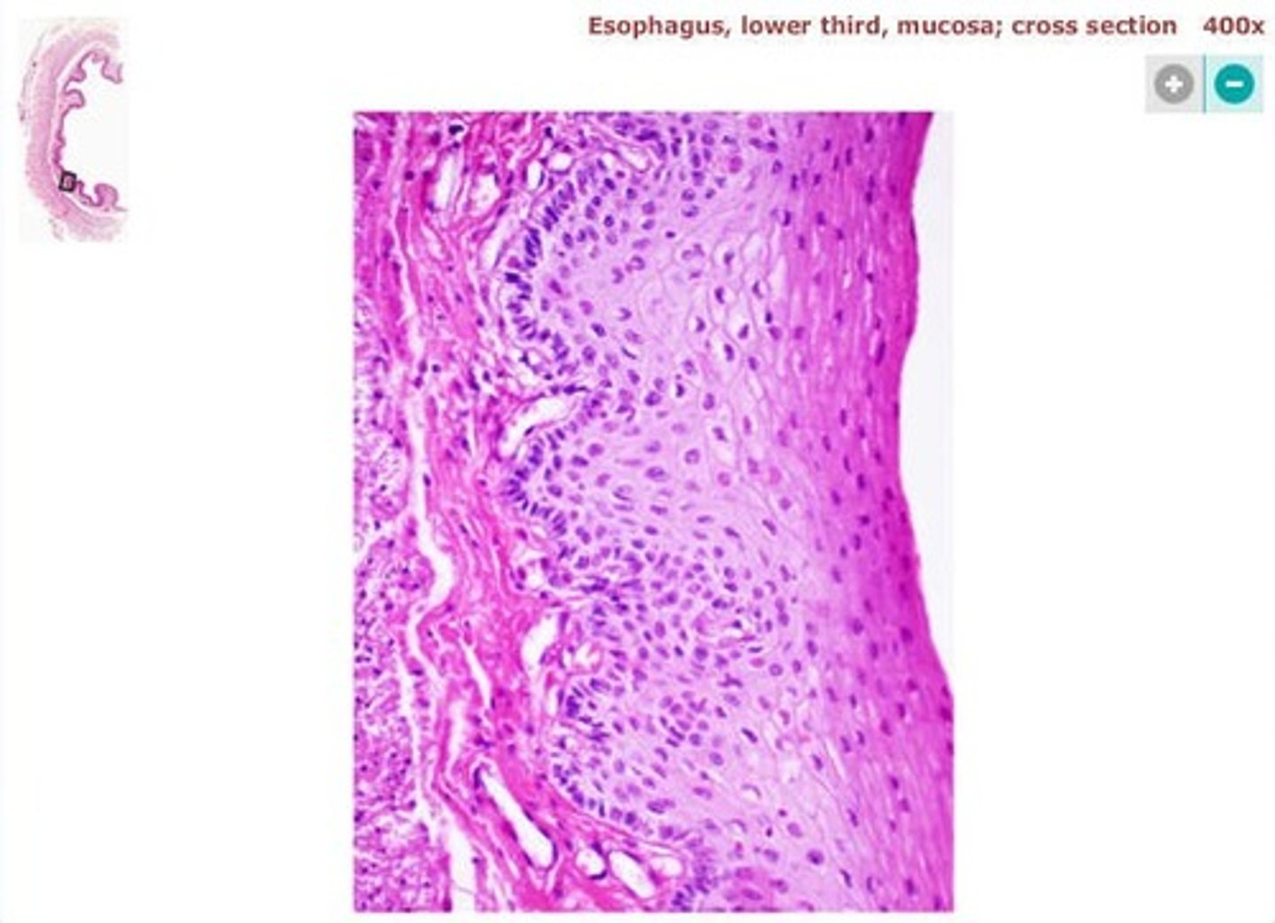 <p>esophagus</p>