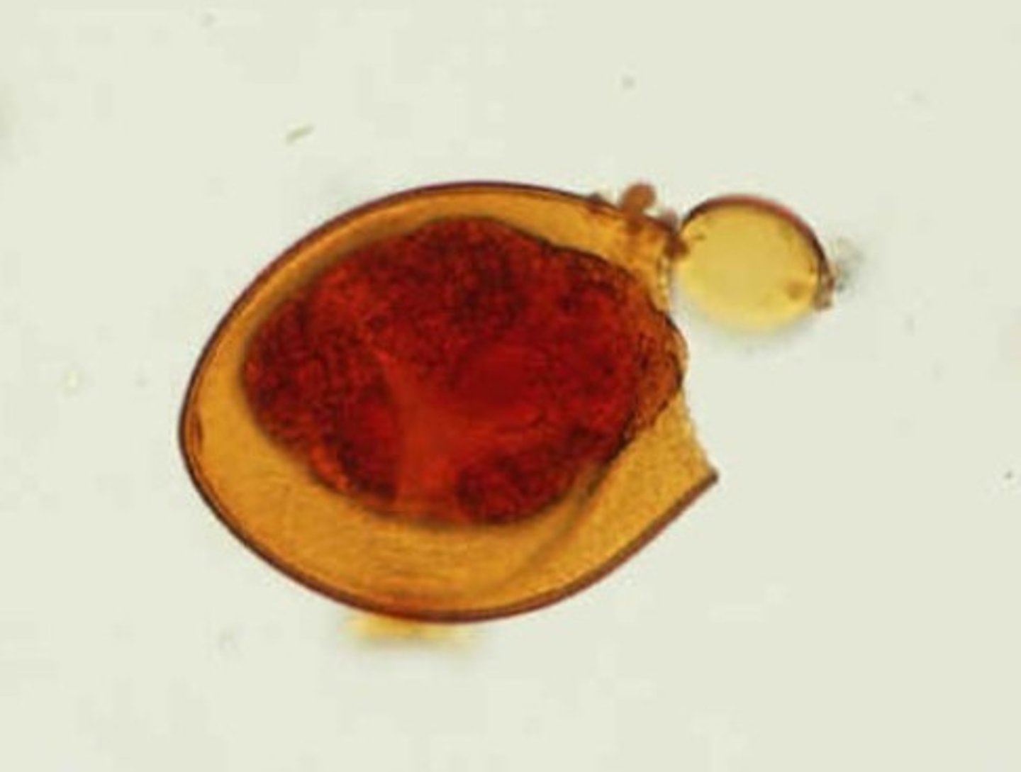 <p>Identify the parasite</p>