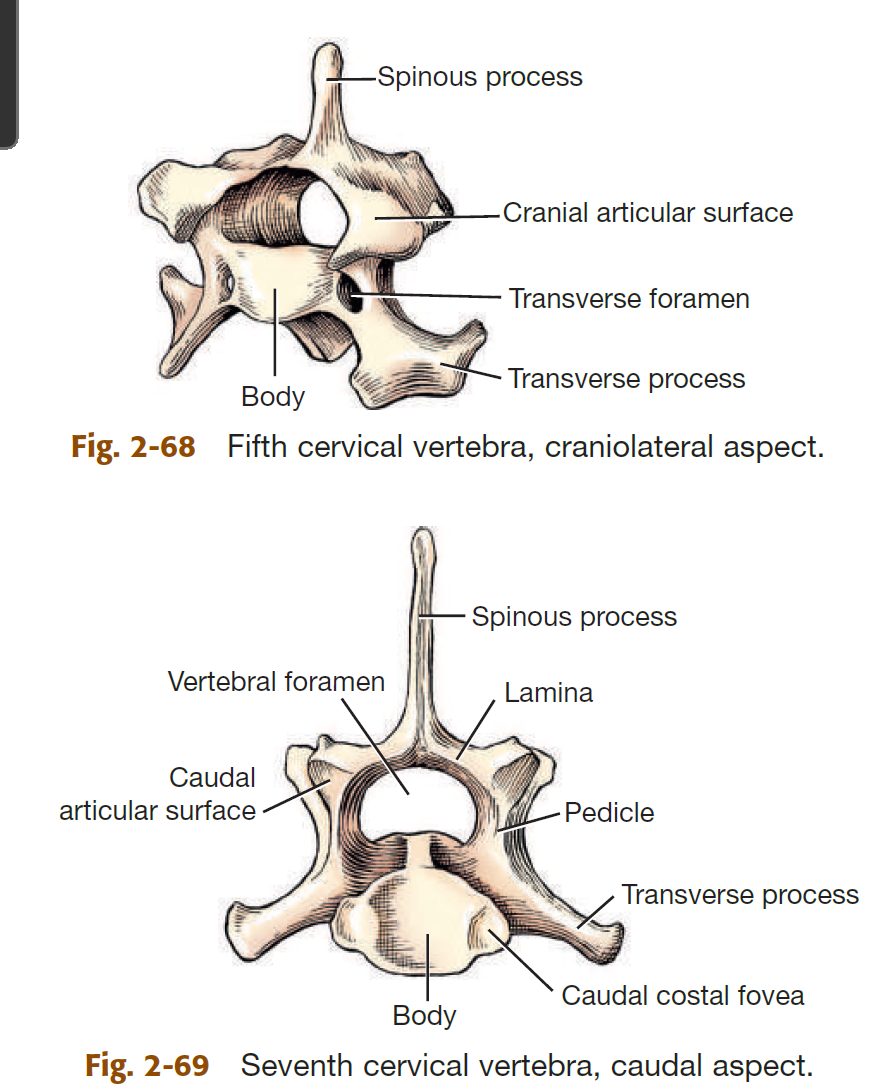 <ol><li><p>body</p></li><li><p>vertebral arch (formed by pedicles &amp; laminae)</p></li><li><p>tranverse, spinous, &amp; articular processes</p></li></ol><p></p>