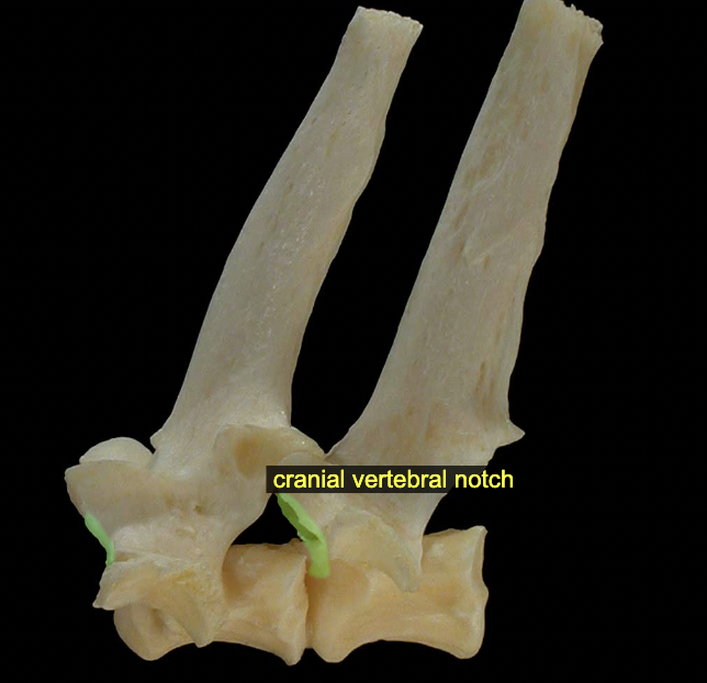 <p>Vertebral notches (cranial &amp; caudal)</p>