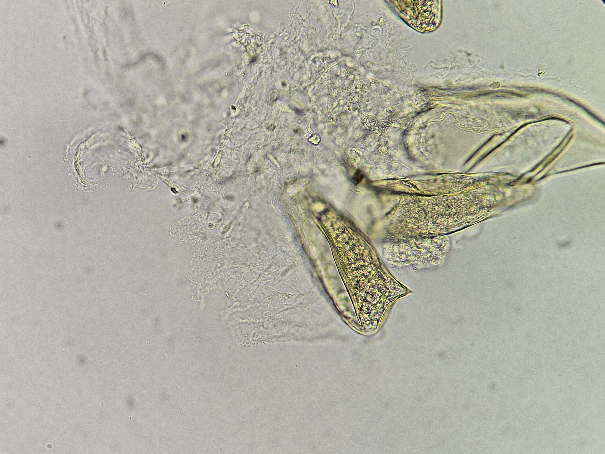 <p><span data-name="microscope" data-type="emoji">🔬</span><span data-name="petri_dish" data-type="emoji">🧫</span><strong><span> </span>Na podstawie zdjęcia preparatu:</strong></p><p></p><ul><li><p><span data-name="book" data-type="emoji">📖</span><span> </span>rozpoznaj gatunek pasożyta;</p></li></ul><p></p><ul><li><p><span data-name="recycle" data-type="emoji">♻</span><span> </span>rozpoznaj wszystkie formy rozwojowe;</p></li></ul><p></p><ul><li><p><span data-name="microbe" data-type="emoji">🦠</span><span> </span>wskaż organelle i cechy charakterystyczne dla danego gatunku;</p></li></ul><p></p><ul><li><p><span data-name="mask" data-type="emoji">😷</span><span> </span>nazwij chorobę, którą pasożyt wywołuje.</p></li></ul><p></p>