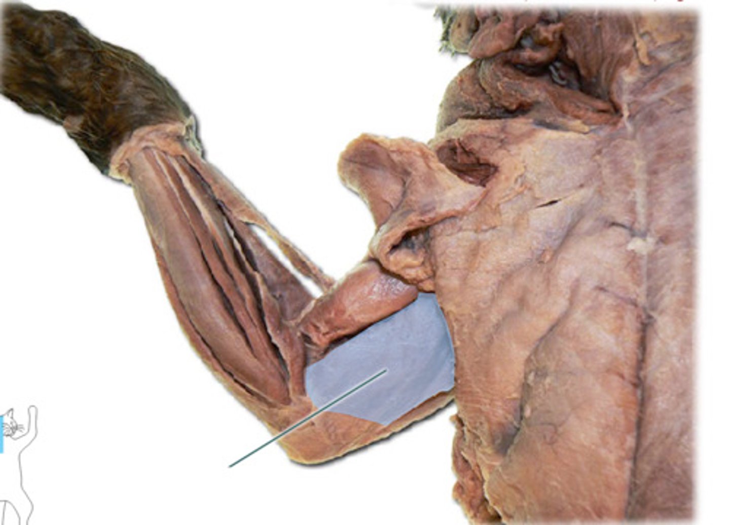 <p>upon + pulley</p>