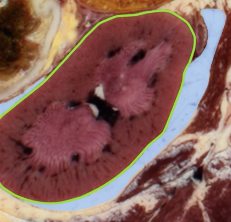 <p>green and blue surrounding each kidney</p>
