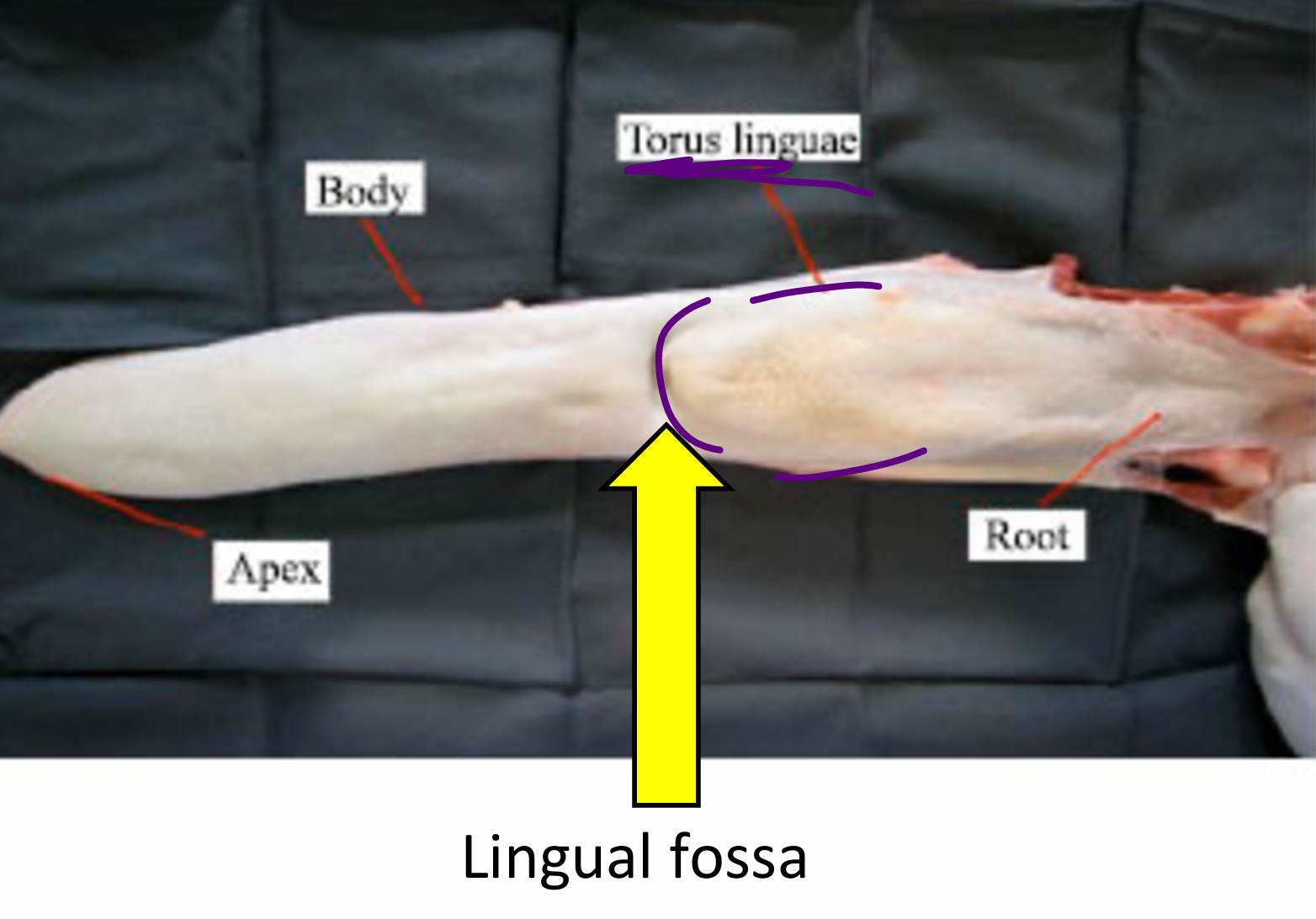 <ul><li><p>A bulging of the caudodorsal surface of the tongue </p><ul><li><p>Aids in rumination (cud) and mastication</p></li></ul></li></ul><p></p>