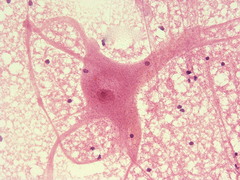 This type of tissue controls. In the brain, spinal cord, and nerves.
