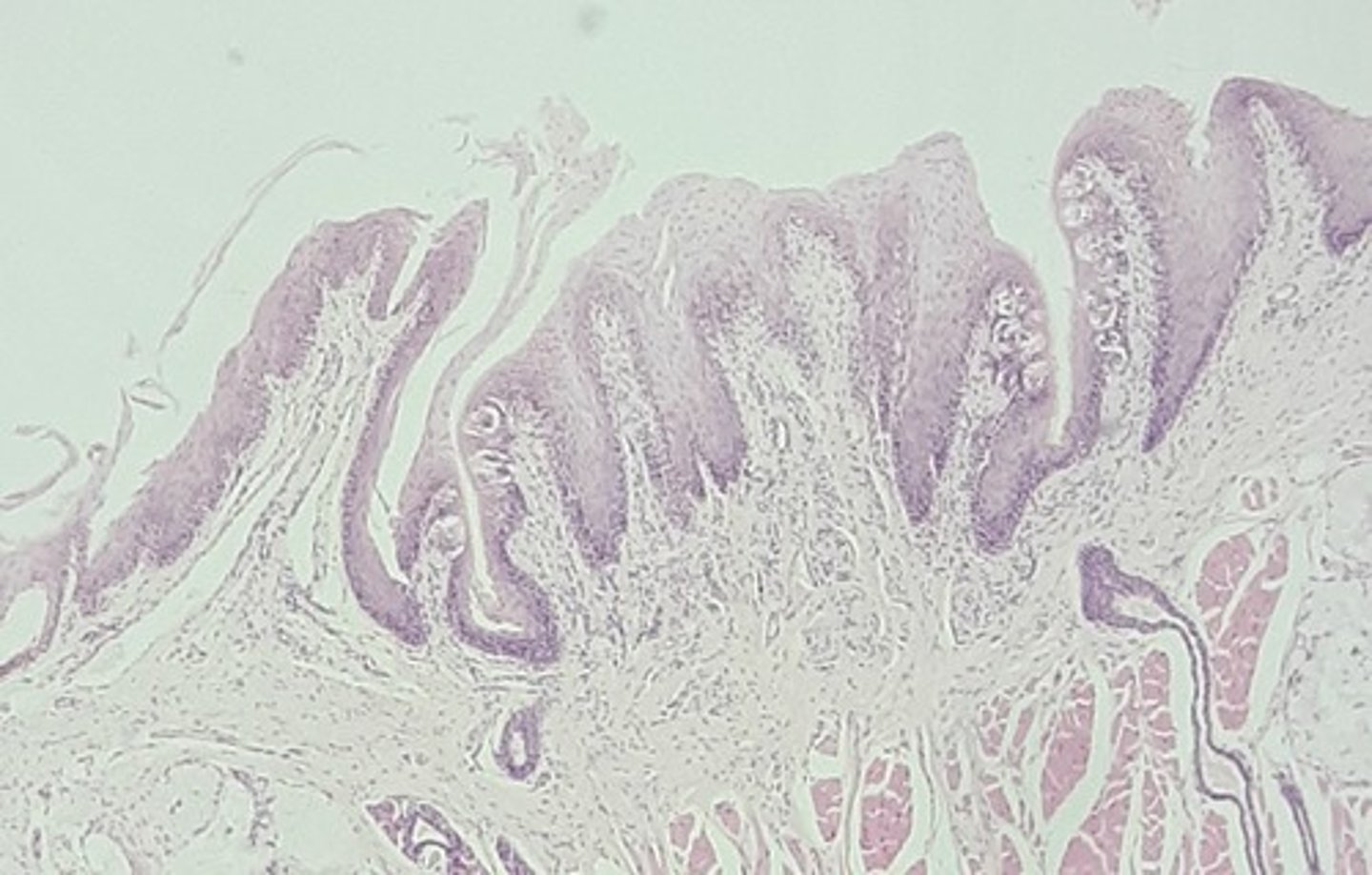 <p>Special: Taste elevations on the tongue's surface that house 100-300 taste buds per papillae; there are roughly 12 of them; they</p><p>form an inverted "v" on the posterior aspect of the tongue</p>