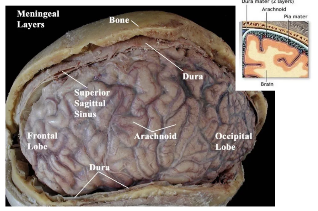 <p>dura → pia → arachnoid</p>