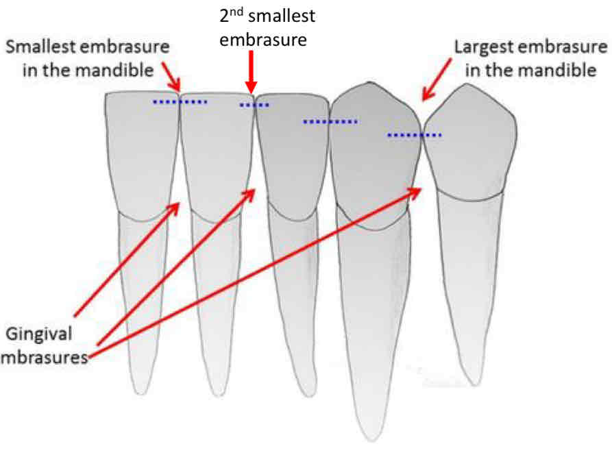<p>what are the three smallest embrasures?</p>