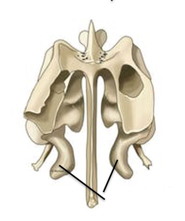 <p>What bone structure are the arrows pointing to?</p>