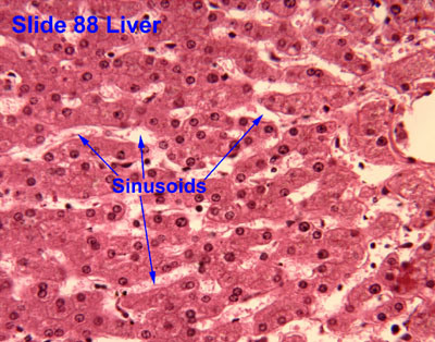 - Hepatocytes arranged in lobules 
- Sinusoids in between hepatocytes are blood-filled spaces 
- Kupffer cells phagocytize microbes & foreign matter