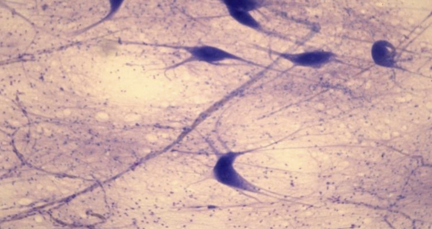 What cell type is this?