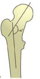 <p>Nom et caractéristiques de ce phénomène ?</p>