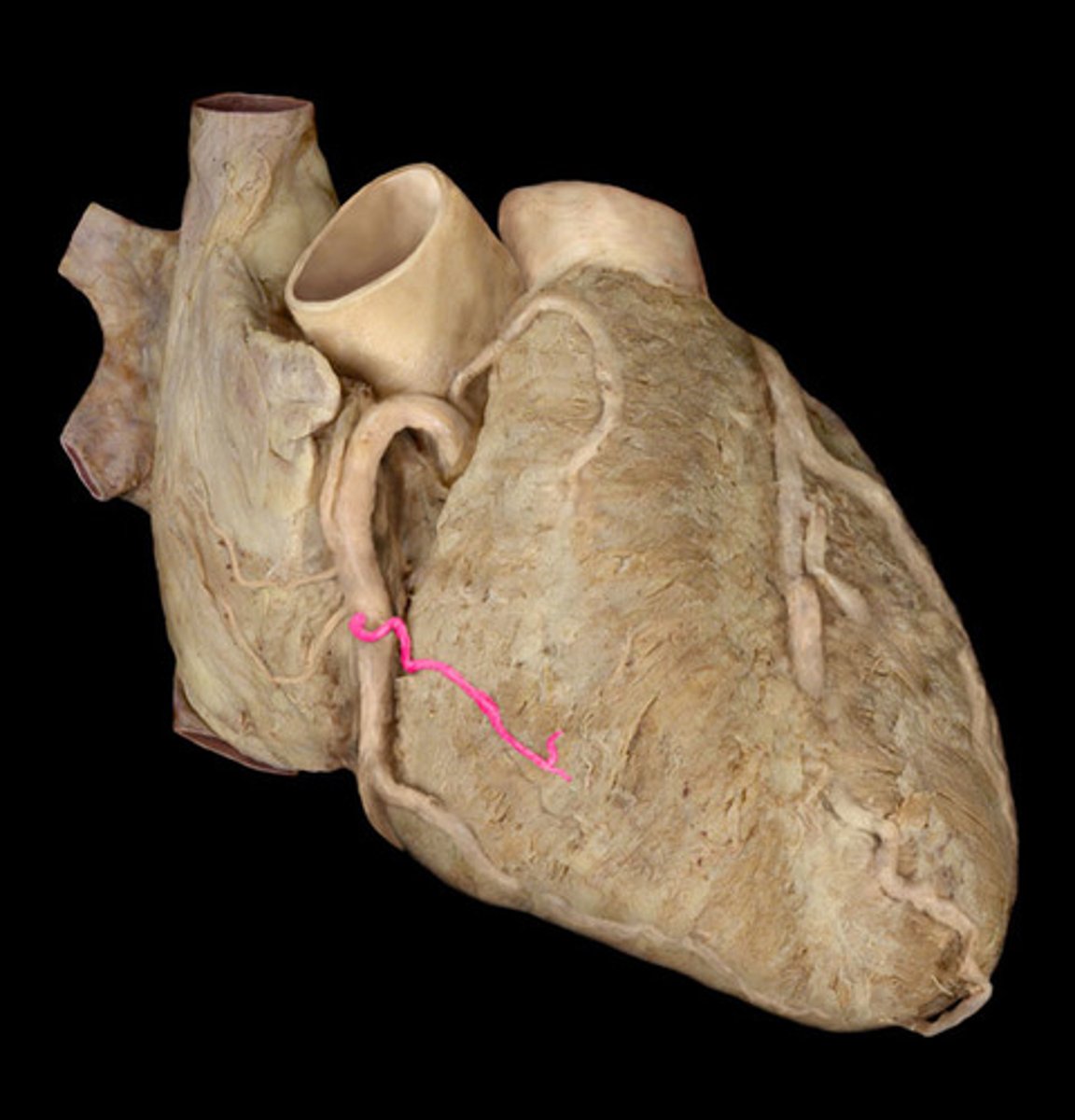 <p>right coronary artery branch</p>