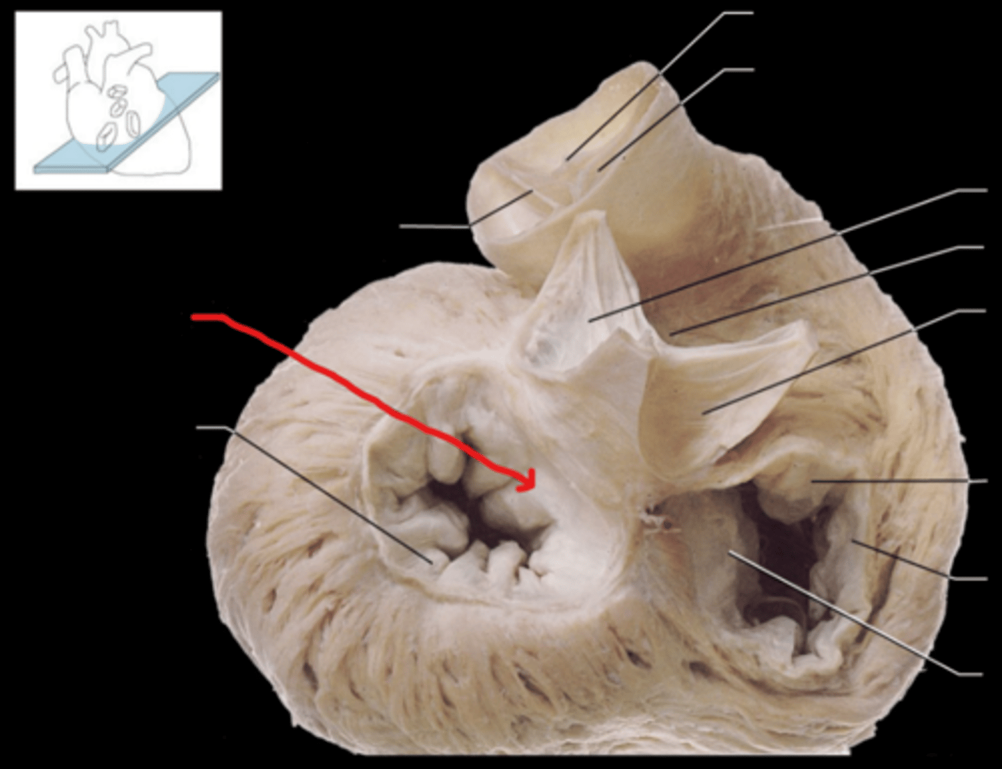 <p>Name the Structure of the Left Ventricle</p>