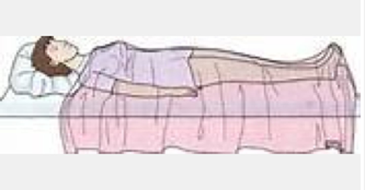 <p>also known as supine position, patient is lying on the back with the face up</p>