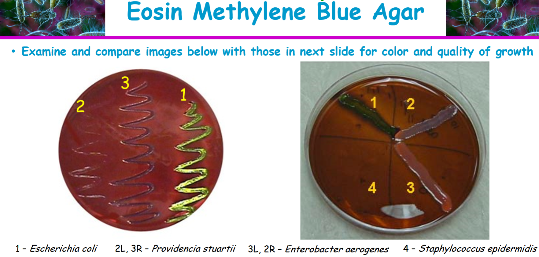 <p>staphylococcus epidermidis</p>
